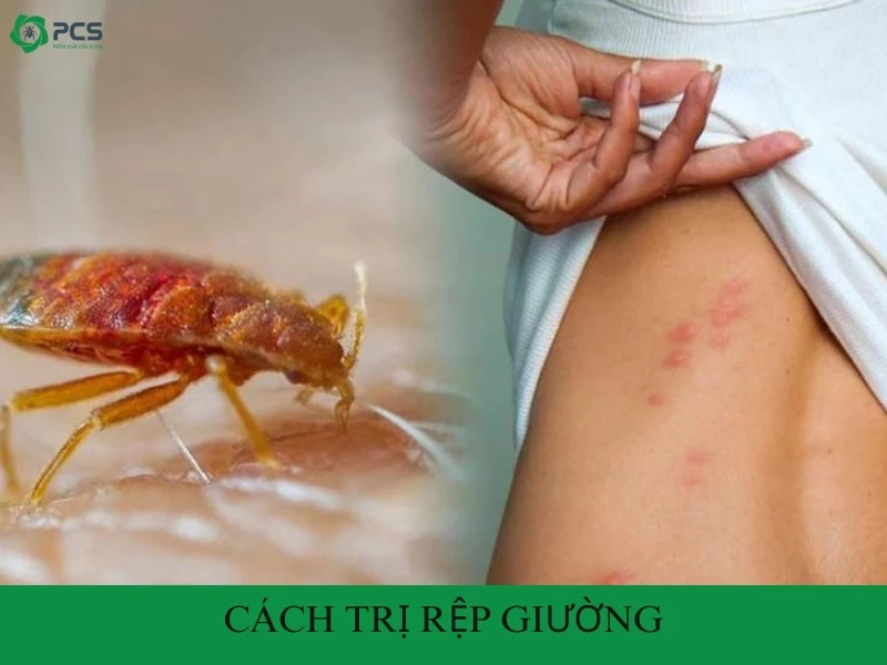 9 Cách trị rệp giường nhanh chóng bạn không nên bỏ qua