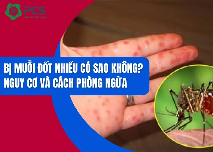 Bị muỗi đốt nhiều có sao không? Nguy cơ và cách phòng ngừa